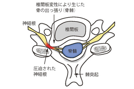 頚椎横面図